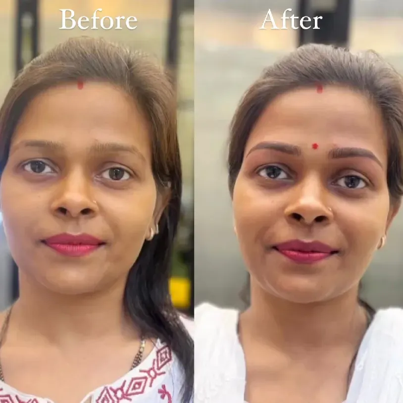Combination Brows result — Golden Ratio by Priyanka, Bengaluru