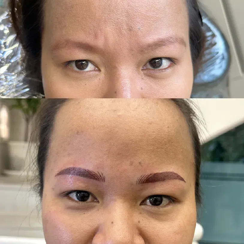 Before and after PMU result — Golden Ratio by Priyanka