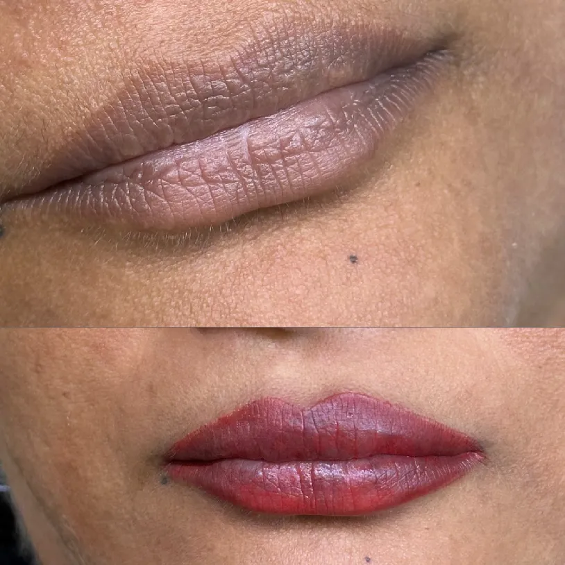 Before and after PMU result — Golden Ratio by Priyanka