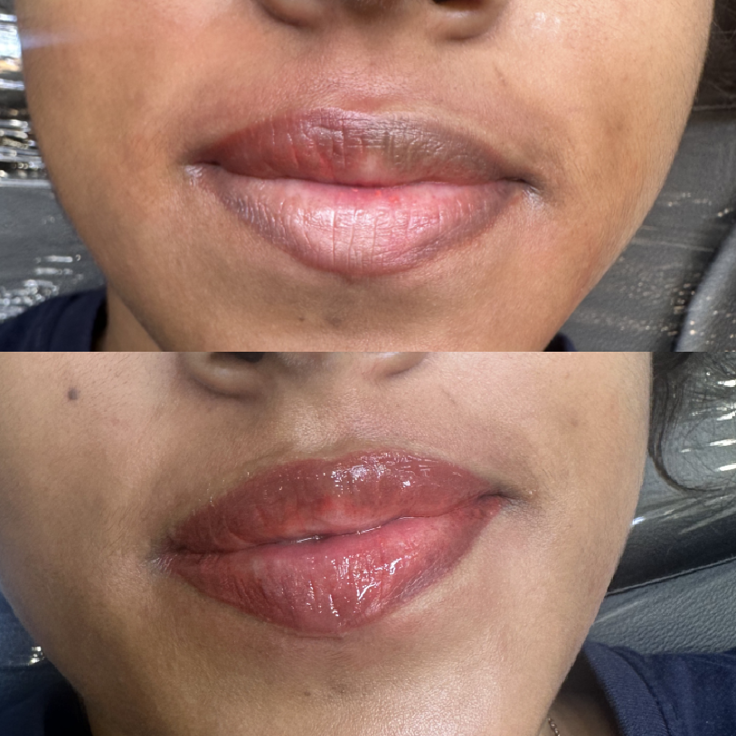 Lip blush result — Golden Ratio by Priyanka, Bengaluru