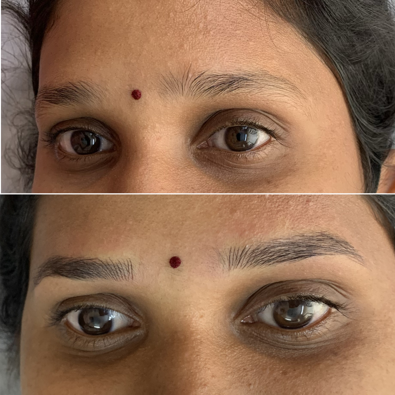 Microblading result — Golden Ratio by Priyanka, Bengaluru