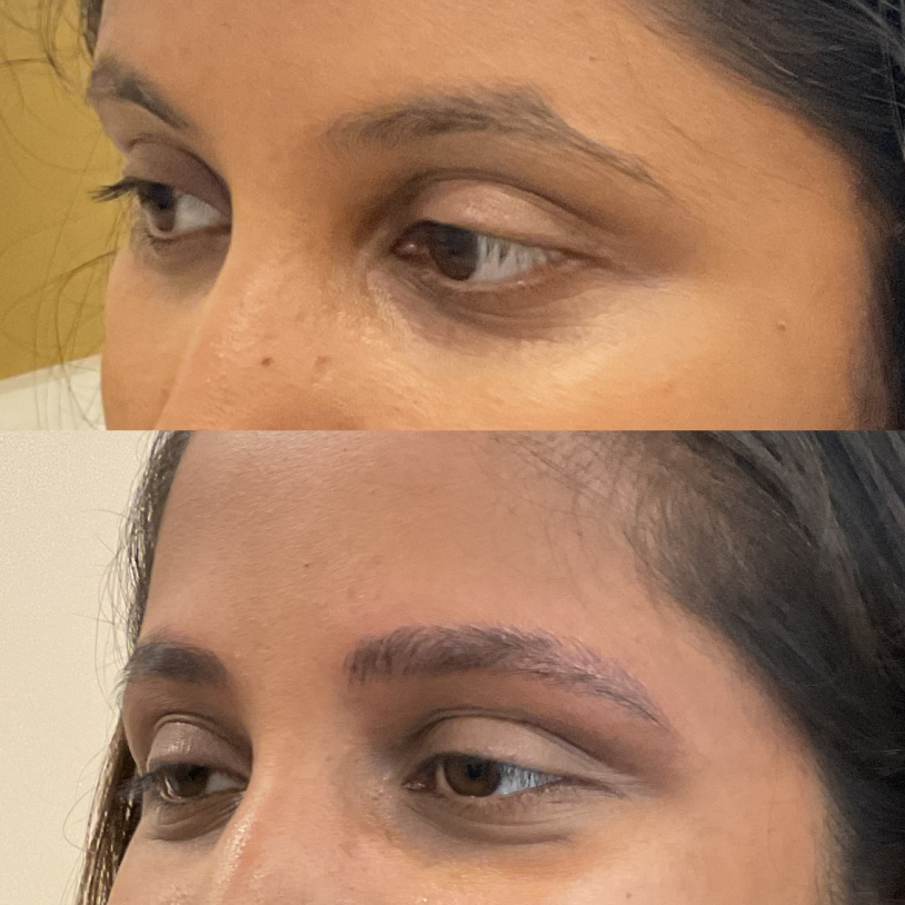 Microblading before and after — Golden Ratio by Priyanka, Bengaluru